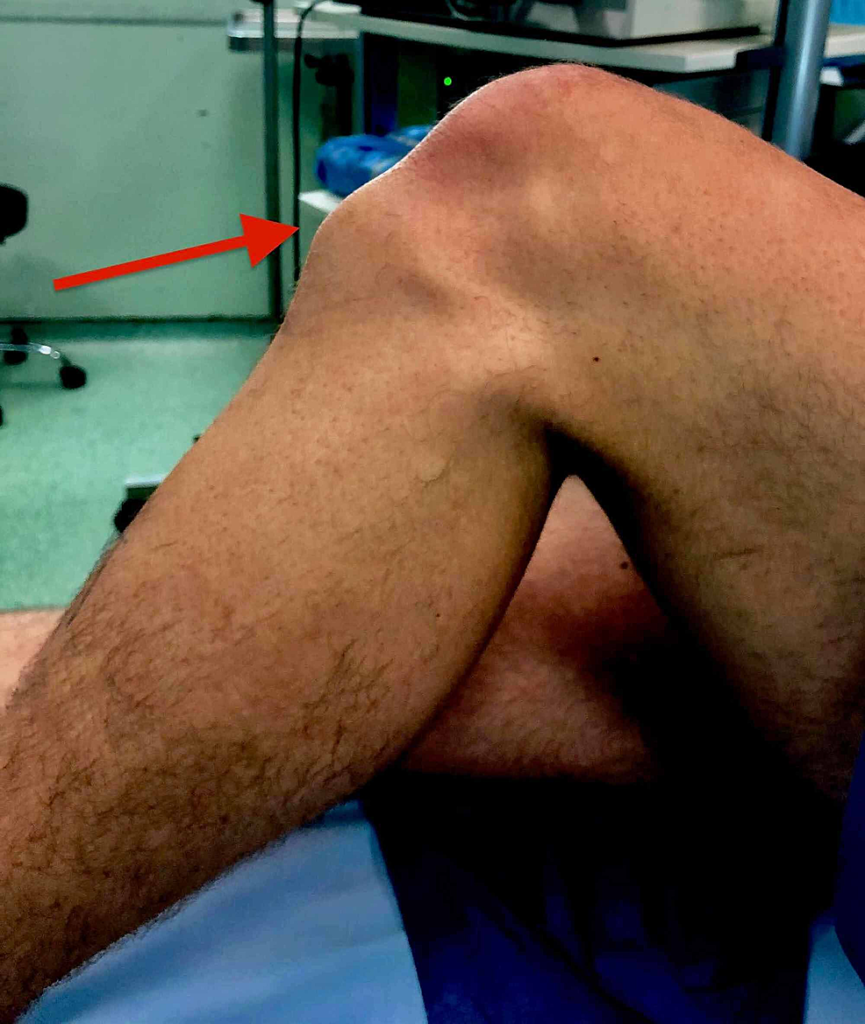 Schlatter